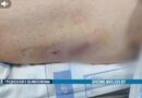 В милицию из учреждения здравоохранения поступила информация об экстренной госпитализации с огнестрельными ранениями 60-летнего жителя Гродненщины